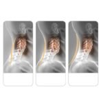 oreiller_pour_arthrose_cervicale_7